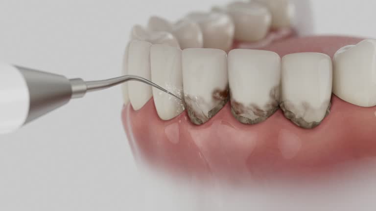 Trusted Teeth Cleaning And Checkup service in Cornish, ME - Dentist Open Now